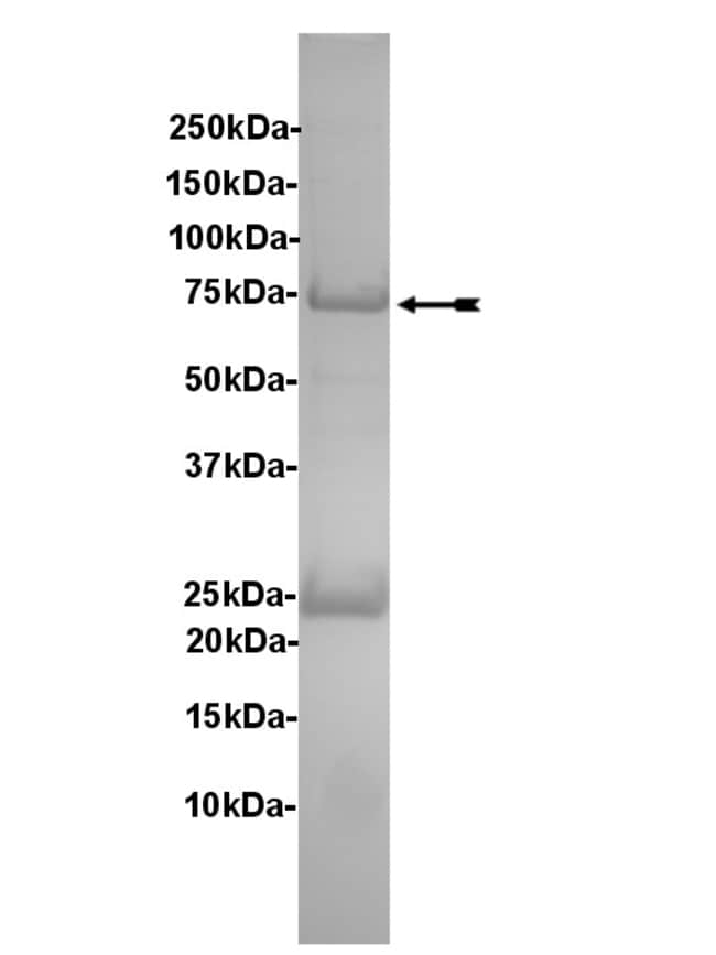 Eurofins DiscoverX Flt3 (D835Y) Protein, Active Quantity 250 μg